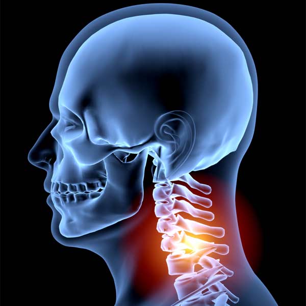 AM&WC offers many treatment options for Neck Pain
