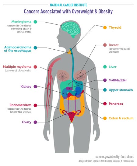 Cancers and Obesity Information