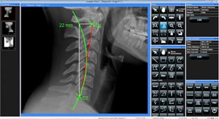 Beavercreek Chiropractic now offers Digital X Rays Analysis